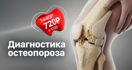 С 1 по 31 мая "Диагностика остеопороза" со скидкой 50%